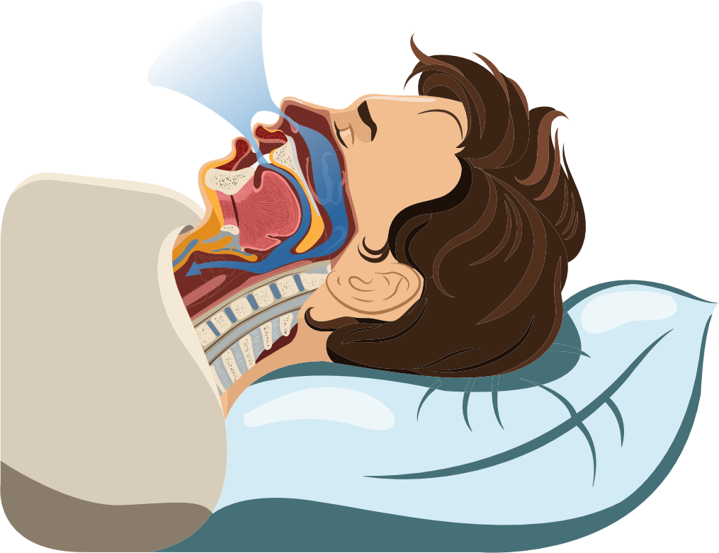 Head Open